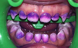 Dentista de Niños Dentista de Niños